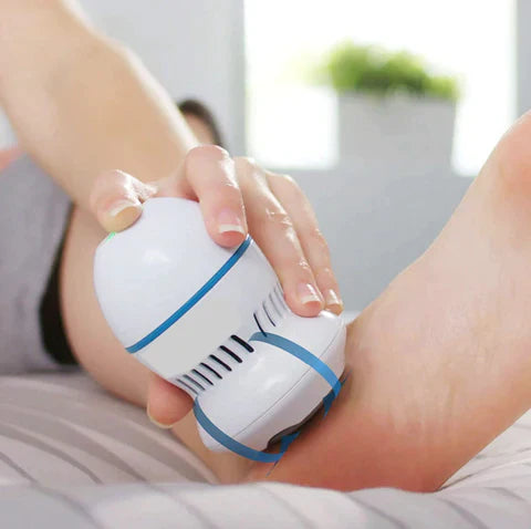 Removedor de Calos Premium 🦶✨