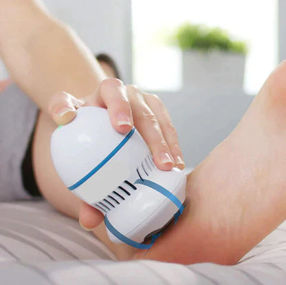 Removedor de Calos Premium 🦶✨