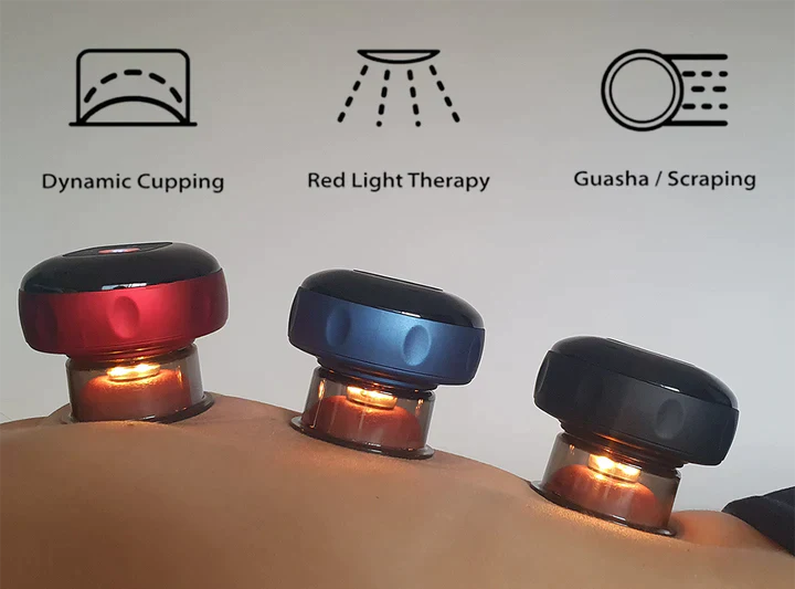 SmartCup – Terapia de Ventosas Inteligente 🔴💆♀️