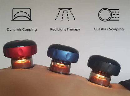 SmartCup – Terapia de Ventosas Inteligente 🔴💆♀️